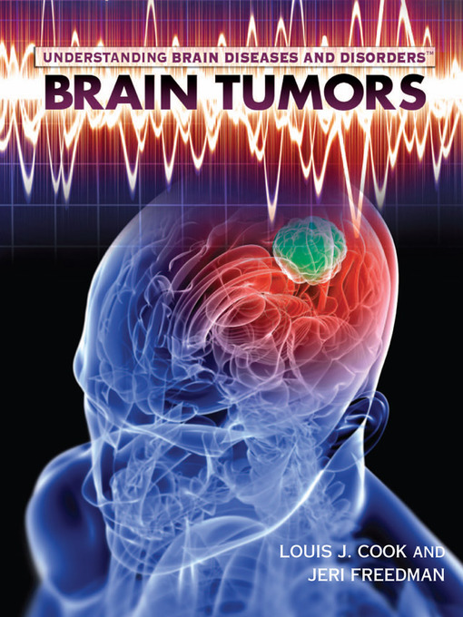 Title details for Brain Tumors by Louis J. Cook - Available